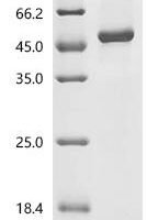 Human Glycogen synthase kinase-3 beta (GSK3B)(K85P) Recombinant Protein - BioCrest Sci