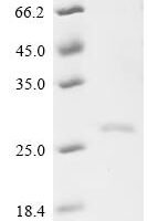 Bos indicus x Bos taurus Kappa-casein, partial (R118C,T156I,I157T,A169D,S176R), partial Recombinant Protein - BioCrest Sci