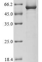 Rat Angiopoietin-2 (Angpt2) Recombinant Protein - BioCrest Sci