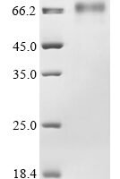 Rat Noelin-3 (Olfm3) Recombinant Protein - BioCrest Sci