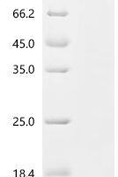 Mouse Nucleolar RNA helicase 2 (Ddx21) Recombinant Protein, C-His - BioCrest Sci