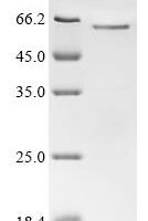 Human Cyclin-A2 (CCNA2) Recombinant Protein - BioCrest Sci