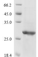 Avian infectious bronchitis virus Spike glycoprotein (S), partial Recombinant Protein, C-His, aa 318–538 - BioCrest Sci