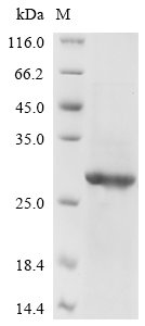 Avian infectious bronchitis virus Spike glycoprotein (S), partial Recombinant Protein, C-His, aa 318–538, Avian infectious bronchitis virus (strain D274) (IBV), E.coli, C-terminal 6xHis-tagged, 27.2 kDa, purity >≥ 85% as determined by SDS-PAGE.