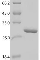 Cat Prolactin (PRL) Recombinant Protein, C-His, aa 31–229, E.coli - BioCrest Sci