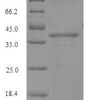 Human Glutathione S-transferase A4 (GSTA4) Recombinant Protein, N-His-SUMO - BioCrest Sci