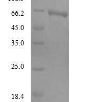 Human Mesoderm induction early response protein 2 (MIER2) Recombinant Protein - BioCrest Sci