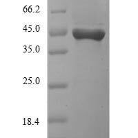 Human Killer cell immunoglobulin-like receptor 2DS3 (KIR2DS3), partial Recombinant Protein, N-10His-SUMO/C-Myc - BioCrest Sci