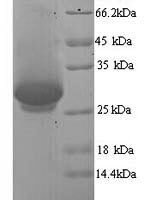 Human Dynamin-1 (DNM1), partial Recombinant Protein, N-His, aa 2–245, Yeast - BioCrest Sci
