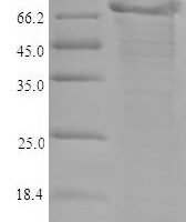 Mouse A disintegrin and metalloproteinase with thrombospondin motifs 5 (Adamts5) Recombinant Protein - BioCrest Sci