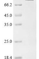 Escherichia coli Aconitate hydratase Recombinant Protein, C-His - BioCrest Sci