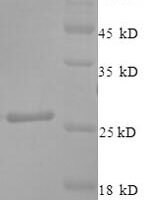 Human Ciliary neurotrophic factor (CNTF), partial Recombinant Protein - BioCrest Sci