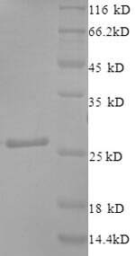 Human Ciliary neurotrophic factor (CNTF), partial Recombinant Protein, Homo sapiens (Human), E.coli, N-terminal 6xHis-tagged, 26.1 kDa, purity >≥ 90% as determined by SDS-PAGE.
