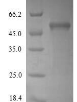 Saccharomyces cerevisiae Hexokinase-1 (HXK1), partial Recombinant Protein, N-His, aa 2–485, Yeast - BioCrest Sci
