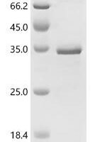 Mouse Transcription intermediary factor 1-beta (Trim28), partial Recombinant Protein - BioCrest Sci