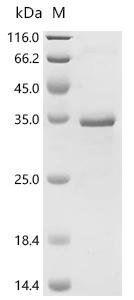 Mouse Transcription intermediary factor 1-beta (Trim28), partial Recombinant Protein, Mus musculus (Mouse), E.coli, C-terminal 6xHis-tagged, 30.6 kDa, purity >≥ 85% as determined by SDS-PAGE.