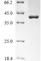 Bovine Apolipoprotein A-I (APOA1), partial Recombinant Protein - BioCrest Sci