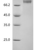 Human MHC class I polypeptide-related sequence B (MICB), partial Recombinant Protein, C-hFc1 - BioCrest Sci