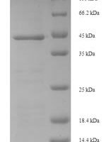 Drimia maritima Ribosome-inactivating protein charybdin Recombinant Protein, N-His-SUMO - BioCrest Sci