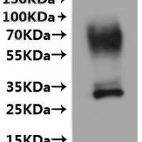 Human Urea transporter 1 (SLC14A1)-VLPs Recombinant Protein - BioCrest Sci
