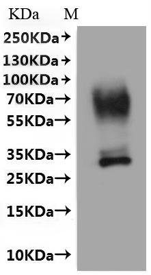 Human Urea transporter 1 (SLC14A1)-VLPs Recombinant Protein, Homo sapiens (Human), Mammalian cell, C-terminal 10xHis-tagged(This tag can be tested only under denaturing conditions), 43.9 kDa, purity >The purity information is not available for VLPs proteins.