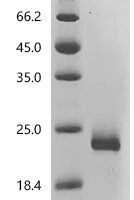 Human Interleukin-4 (IL4), Biotinylated Recombinant Protein - BioCrest Sci