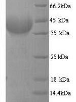 Plasmodium falciparum Multidrug resistance protein (MDR1), partial Recombinant Protein, N-His - BioCrest Sci