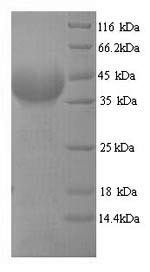 Plasmodium falciparum Multidrug resistance protein (MDR1), partial Recombinant Protein, N-His, Plasmodium falciparum (isolate FC27 / Papua New Guinea), Yeast, N-terminal 6xHis-tagged, 40.2 kDa, purity >≥ 90% as determined by SDS-PAGE.