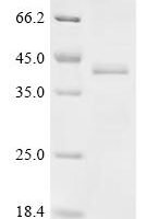 Klebsiella pneumoniae Fimbrial subunit type 3 (mrkA) Recombinant Protein, N-His-SUMOstar - BioCrest Sci