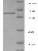 Staphylococcus aureus Enterotoxin type E (entE) Recombinant Protein, N-His-SUMO - BioCrest Sci
