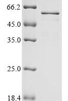 Human coronavirus HKU1 Nucleoprotein (N) Recombinant Protein, N-10His/C-Myc, aa 1–441, Baculovirus - BioCrest Sci