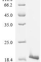 Human Transcription factor E2-alpha (TCF3), partial Recombinant Protein, C-His - BioCrest Sci