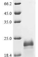 Hepatitis delta virus genotype I Small delta antigen Recombinant Protein, C-His - BioCrest Sci