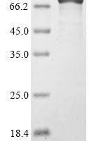 Mouse 1-phosphatidylinositol 4,5-bisphosphate phosphodiesterase delta-1 (Plcd1) Recombinant Protein, C-His - BioCrest Sci