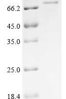 Murid herpesvirus 1 Envelope glycoprotein L (gL), Biotinylated Recombinant Protein - BioCrest Sci