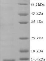 Macaca mulatta C-X-C motif chemokine 10 (CXCL10) Recombinant Protein - BioCrest Sci