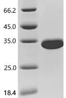 Human Titin (TTN), partial Recombinant Protein, C-His, aa 1–200 - BioCrest Sci