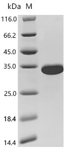 Human Titin (TTN), partial Recombinant Protein, C-His, aa 1–200, E.coli, C-terminal 6xHis-tagged, 28.3 kDa, purity >≥ 95% as determined by SDS-PAGE.