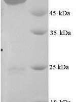 Mouse BAG family molecular chaperone regulator 3 (Bag3) Recombinant Protein, N-His - BioCrest Sci