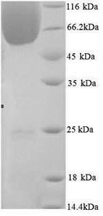 Mouse BAG family molecular chaperone regulator 3 (Bag3) Recombinant Protein, N-His, Mus musculus (Mouse), Yeast, N-terminal 6xHis-tagged, 63.7 kDa, purity >≥ 90% as determined by SDS-PAGE.
