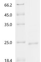 Mouse Protein E6 (E6) Recombinant Protein - BioCrest Sci