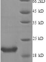 Human Interleukin-1 receptor antagonist protein (IL1RN) Recombinant Protein, N-His - BioCrest Sci