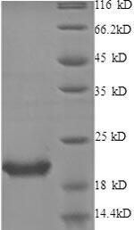Human Interleukin-1 receptor antagonist protein (IL1RN) Recombinant Protein, N-His, Homo sapiens (Human), E.coli, N-terminal 6xHis-tagged, 21.1 kDa, purity >≥ 90% as determined by SDS-PAGE.