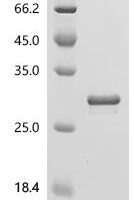 Human Histatin-1 (HTN1) Recombinant Protein, C-hFc1 - BioCrest Sci
