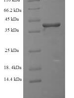 Human Ras-related protein Rab-6A (RAB6A) Recombinant Protein - BioCrest Sci
