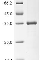 Human ADP-ribosylation factor 1 (ARF1) Recombinant Protein - BioCrest Sci