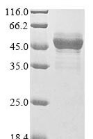 Paeniclostridium sordellii Sialidase Recombinant Protein - BioCrest Sci