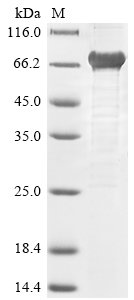 Hepatitis E virus genotype 1 Secreted protein ORF2 (ORF2), partial Recombinant Protein, N-His, Hepatitis E virus genotype 1 (isolate Human/India/Hyderabad) (HEV-1), E.coli, N-terminal 6xHis-tagged, 74.7 kDa, purity >≥ 85% as determined by SDS-PAGE.