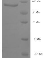 Aspergillus niger 3-phytase A (phyA) Recombinant Protein, N-His-SUMO - BioCrest Sci