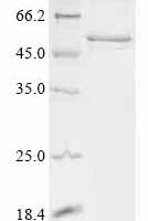 Human Ankyrin repeat and SOCS box protein 11 (ASB11) Recombinant Protein - BioCrest Sci